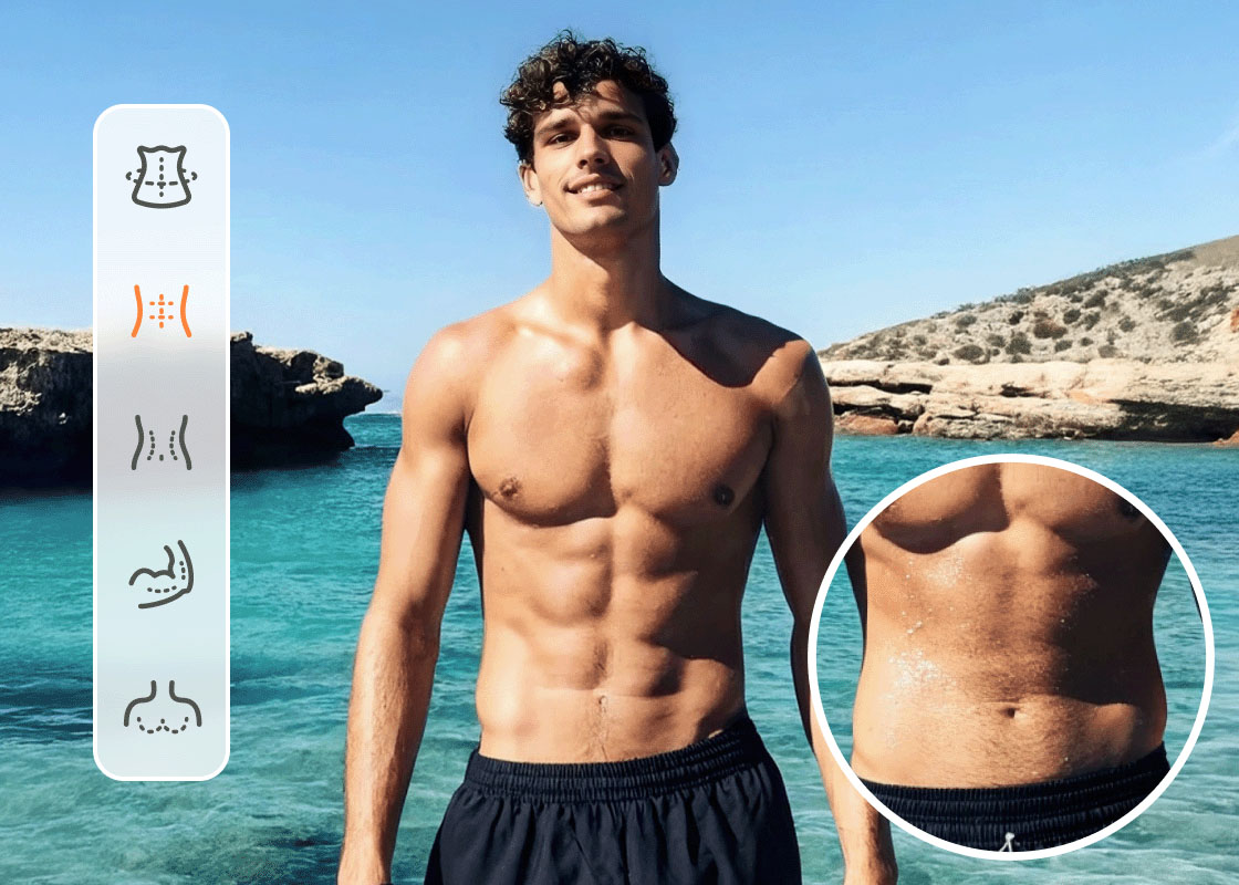Body Editor